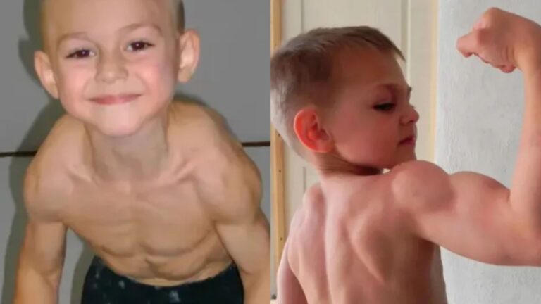 Lembra dele? Saiba como está o ‘menino mais forte do mundo’