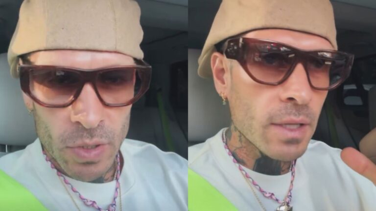 É grave? Influenciador relata problema nas pálpebras causado por cafeína