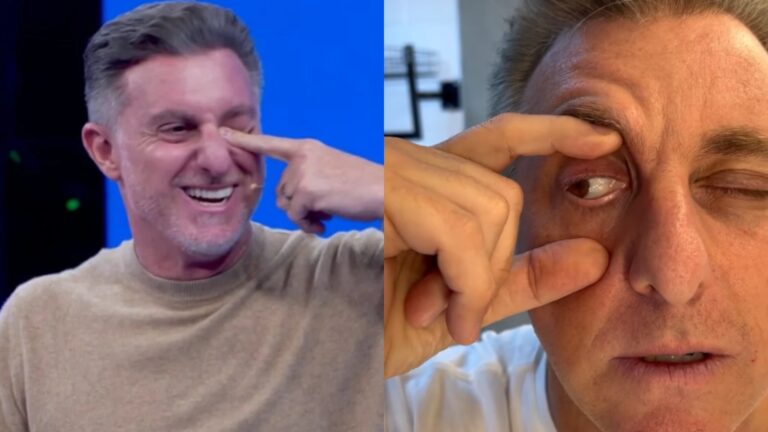 Luciano Huck tem o olho atingido por objeto no Domingão: ‘Tô enxergando só com um’