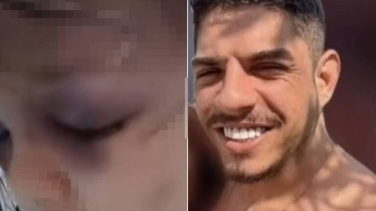 Crime brutal! Padrasto foge após espancar menina de 3 anos