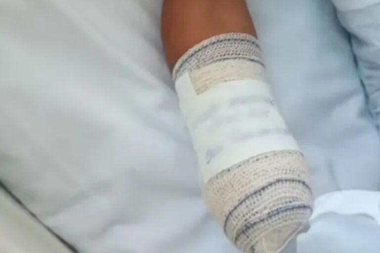Menino de 8 anos sofre amputações após confusão entre bomba e peça de bicicleta no Rio