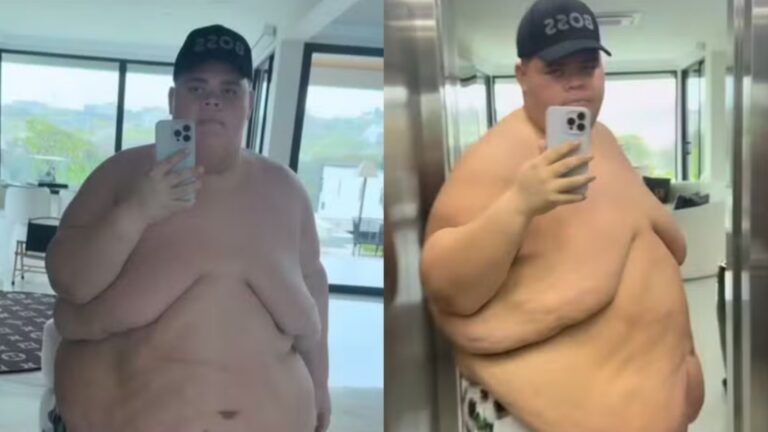Entenda por que Gordão da XJ precisou emagrecer antes de fazer a cirurgia bariátrica