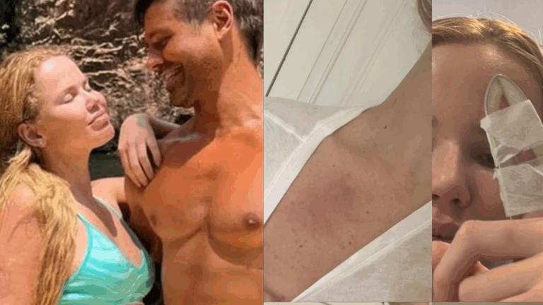 Amiga divulga fotos de Marcela Tomaszewski machucada após ser agredida por Dado Dolabella