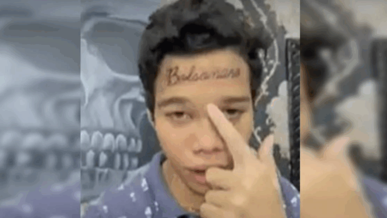 Conseguiu remover? Conheça o jovem que tatuou ‘Bolsonaro’ na testa
