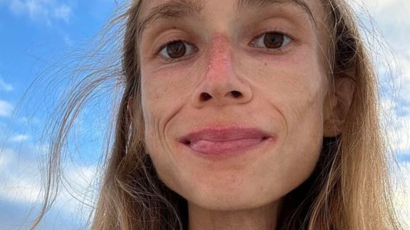 GRAVE! Dançarina é encontrada morta em hotel após fazer dieta extrema