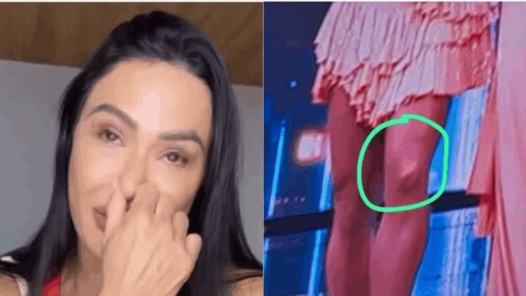 Gracyanne Barbosa cai no choro ao lembrar estalo que ouviu ao romper o tendão no joelho