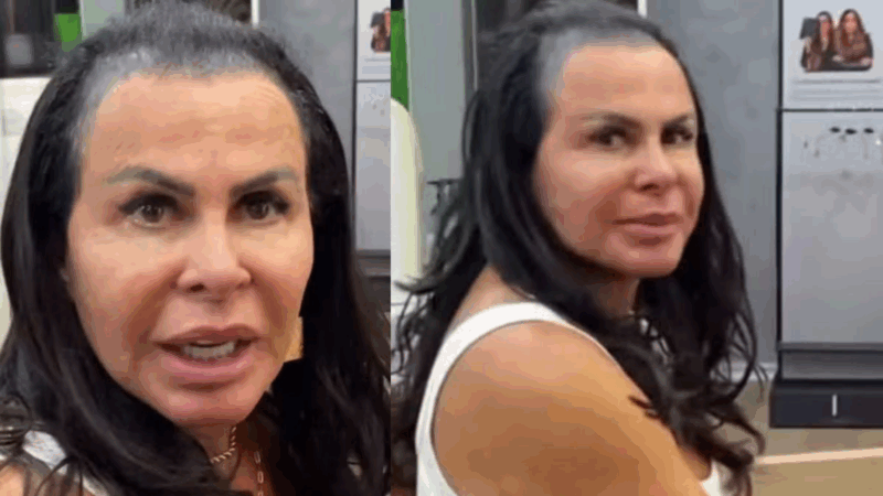 “Não tenho mais cabelo”: Gretchen faz desabafo nas redes sobre doença