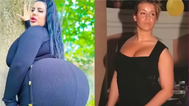 Modelo que gastou R$ 800 mil para ter o ‘maior bumbum do mundo’ revela dificuldades no dia a dia