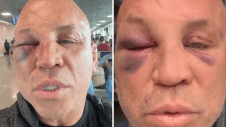 Wanderlei Silva revela que vai entrar na Justiça após sofrer agressões durante confusão