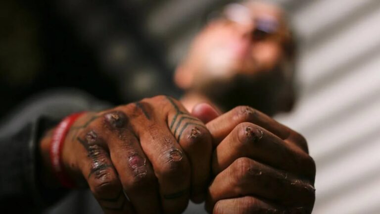 MPDFT acusa 14 PMs de tortura contra soldado durante treinamento