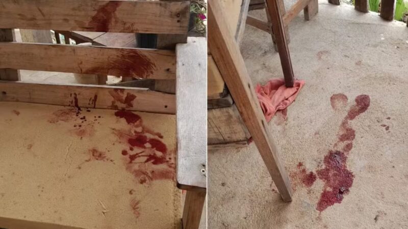 Bebê de 10 meses é atacado por pitbull; saiba o estado de saúde da vítima