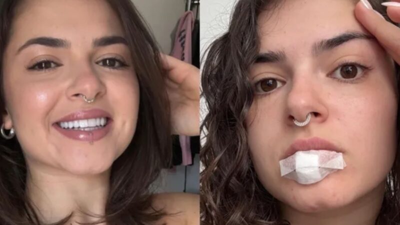Susto! Miss Bumbum sofre acidente com piercing na hora do sexo