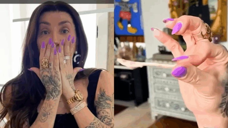 UAU! Maya Massafera mostra como o rosto ficou após retirar ossos do maxilar: ‘Não assustem’