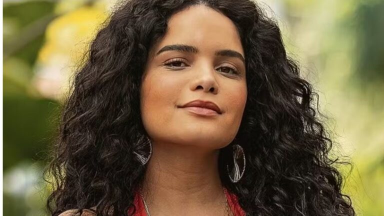 Atriz choca ao revelar que passou por cirurgia após acidente: ‘Não consegui fugir’