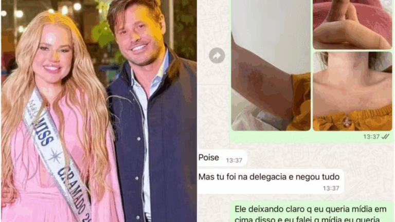 Prints! Ex de Dado Dolabella revela que sofreu diversas agressões do ator