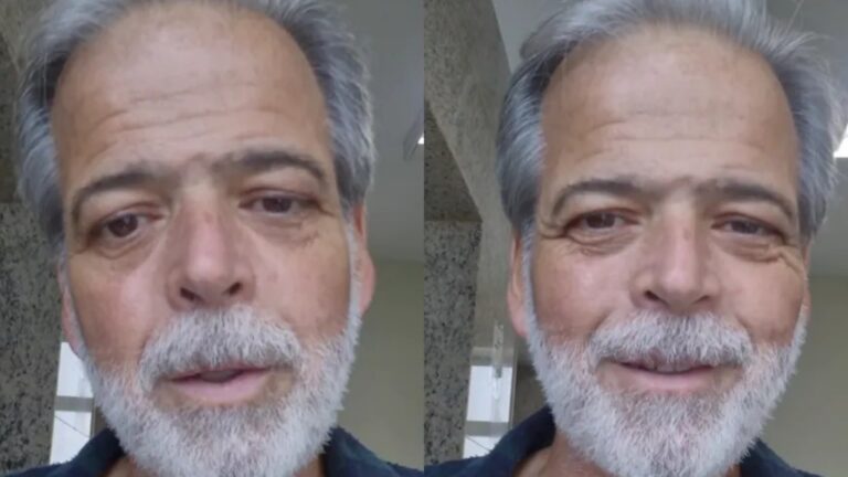 Ex-Zorra Total comemora transplante de rim, expõe drama financeiro e faz apelo por ajuda