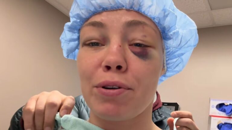 Culpa de brasileira? Ex-campeã do UFC passa por cirurgia e revela restrição após luta