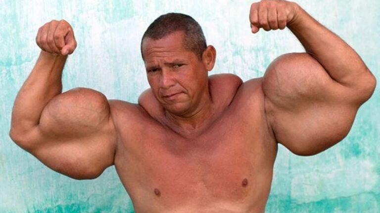 Quem era Arlindo Anomalia, o ‘Popeye Brasileiro’ que conquistou a internet?