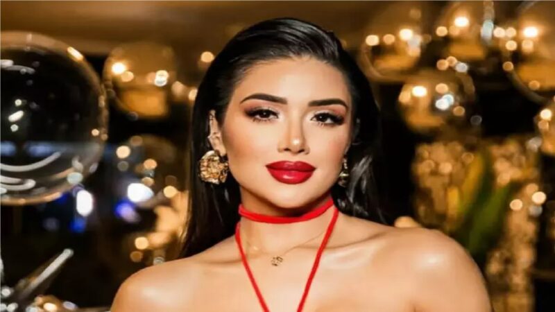 ‘BBB 26’: Veja antes e depois do rosto de Jordana