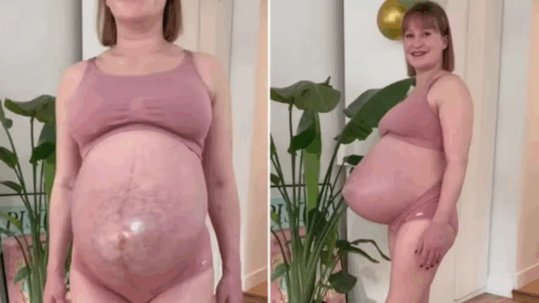 UAU! Grávida com barriga pontuda de trigêmeos viraliza na web: ‘Incrível’