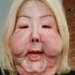 Seis meses após cirurgia delicada, Juju do Pix choca com evolução em processo de reconstrução facial