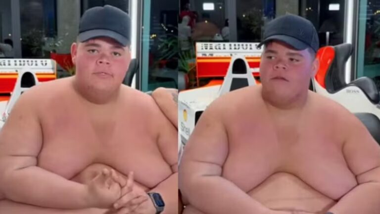 GordãoXJ choca ao revelar por quantas cirurgias precisará passar após perder 130 kg