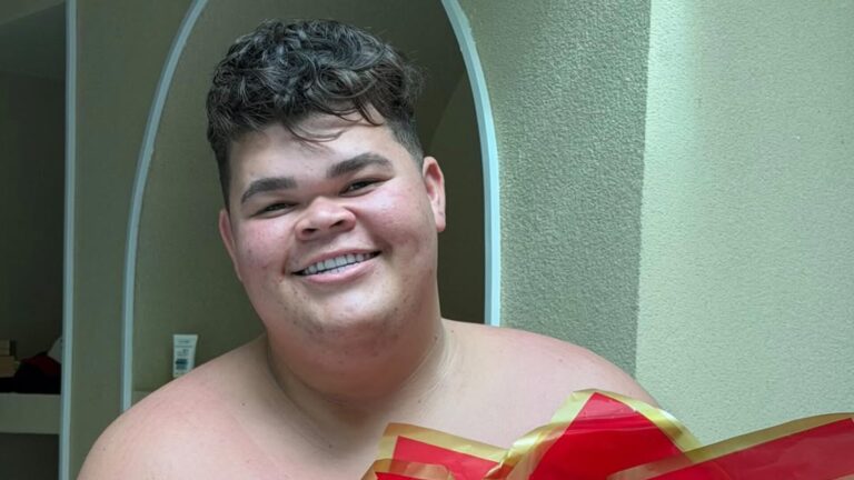 Gordão da XJ passará por cirurgia após perder 130 kg: ‘Estou com medo’
