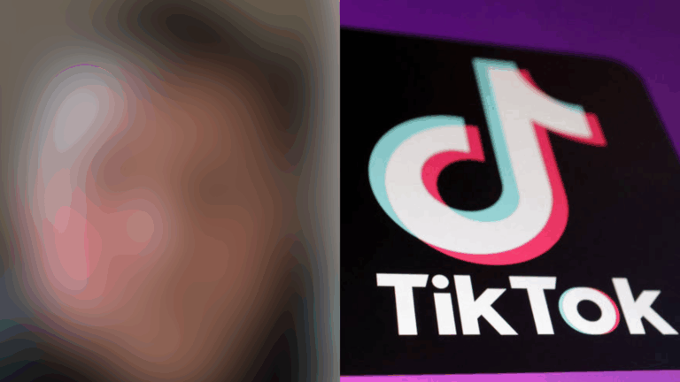 Menino de 9 anos fica com o rosto deformado após fazer desafio no TikTok