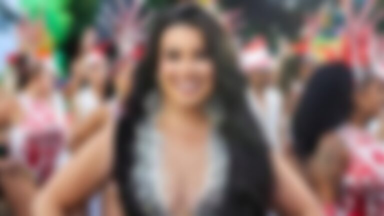 Musa se afasta do Carnaval após reações do uso de caneta emagrecedora