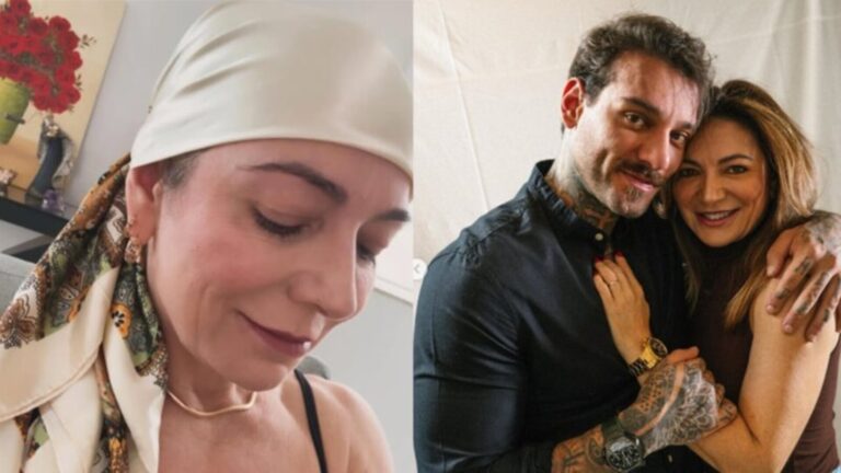 Karina Lucco revela os desafios da medicação durante tratamento de alopecia