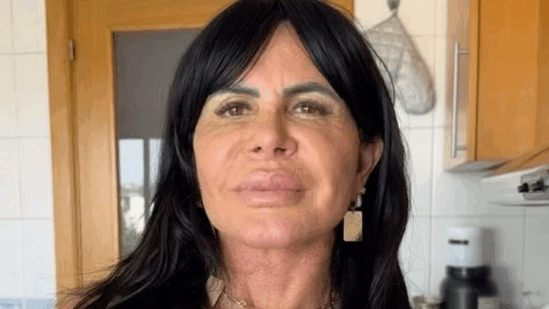 Gretchen explica sobre tratamento contra alopecia e exibe seus cabelos naturais e sem prótese