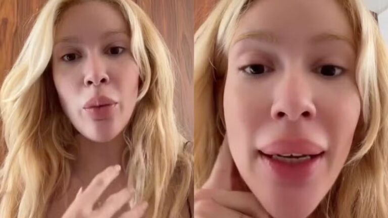 Karoline Lima surge com rosto inchado e preocupa fãs: ‘Chorei muito’