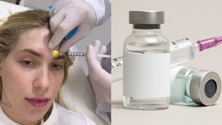 Botox no controle da enxaqueca; saiba o que diz especialista sobre tratamento usado por Virgínia