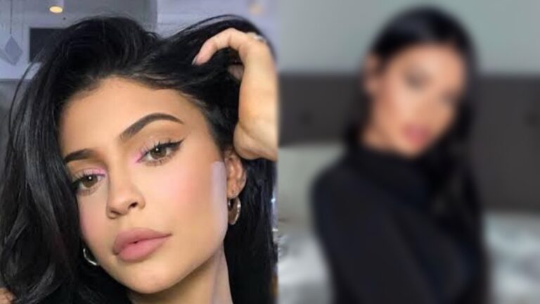 Sósia de Kylie Jenner revela R$ 500 mil em cirurgias: ‘Já não me reconheço’ ao rever fotos antigas