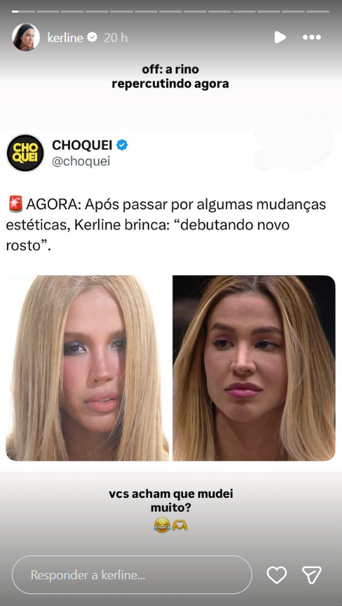 Ex-BBB Kerline choca web com "novo rosto" e revela plásticas- Reprodução/Instagram
