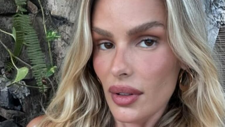Como assim? Yasmin Brunet expõe doença e revela que descobriu por morador de rua