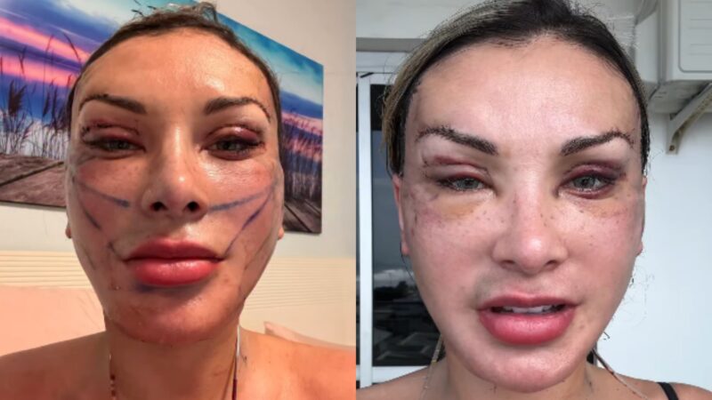 Andressa Urach