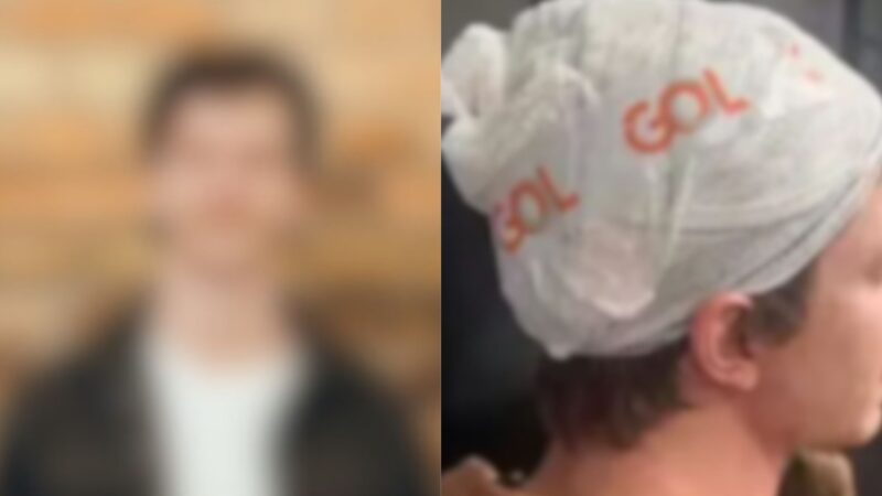 Cantor famoso sofre ferimento na cabeça ao cair durante show; saiba real estado