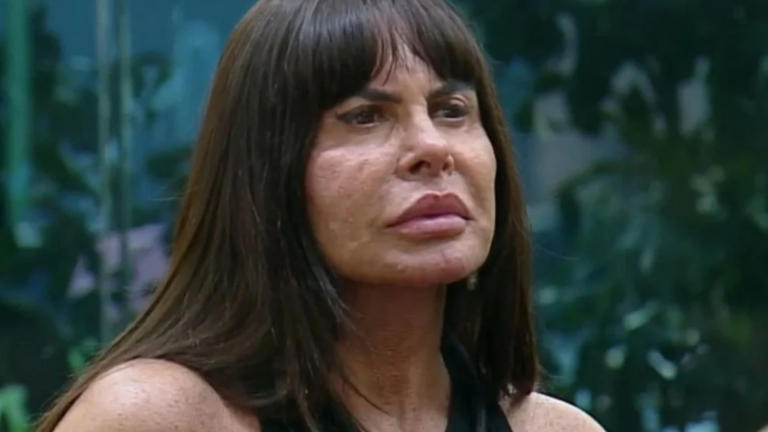 Gretchen revela que fez cirurgia íntima após perder peso: ‘Um pouco sem forma’