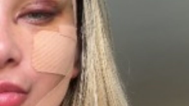 Andressa Urach passa por transformação e choca ao revelar novo procedimento