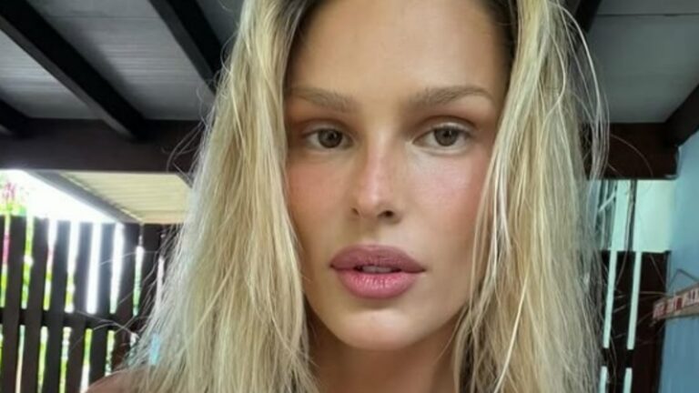 Yasmin Brunet faz revelação chocante sobre doença crônica