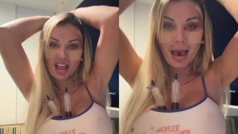 Andressa Urach assusta ao aparecer com rosto modificado e faz revelação: ‘Comunicado importante’