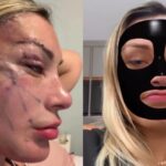 Andressa Urach esconde o rosto e comemora decisão do Conselho Federal de Medicina: ‘Bomba-relógio’