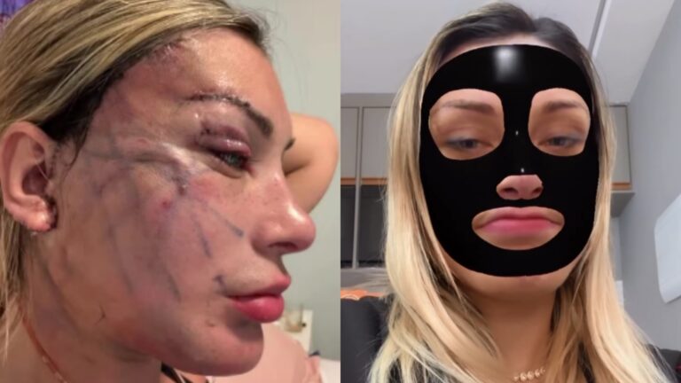 Andressa Urach esconde o rosto e comemora decisão do Conselho Federal de Medicina: ‘Bomba-relógio’