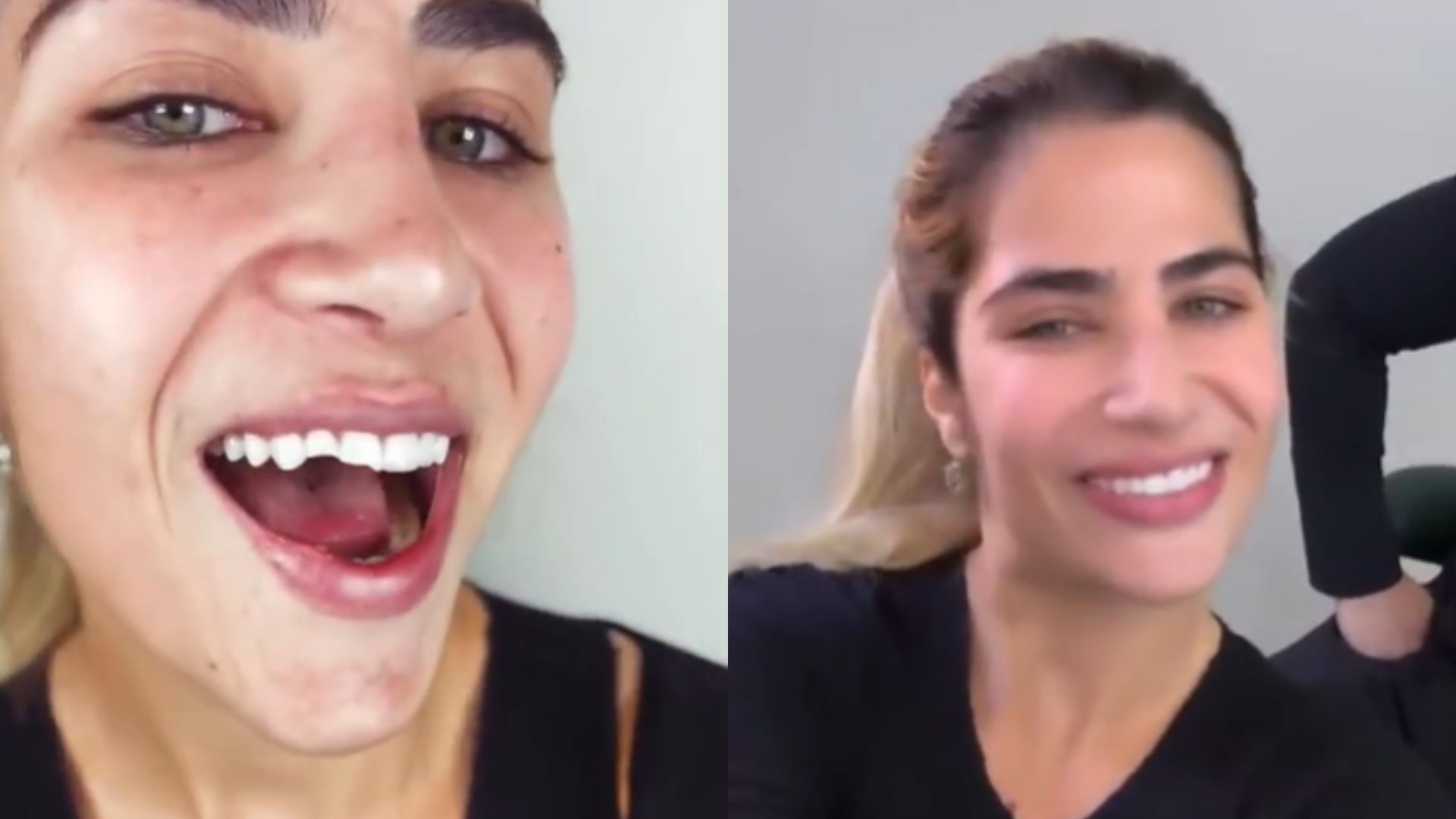 Antes e depois de Jéssica Beatriz Costa - Reprodução/Instagram
