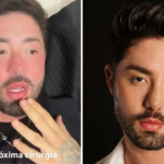 Cutox? Rico Melquiades revela que fará harmonização em parte íntima
