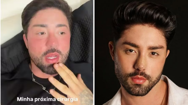 Cutox? Rico Melquiades revela que fará harmonização em parte íntima