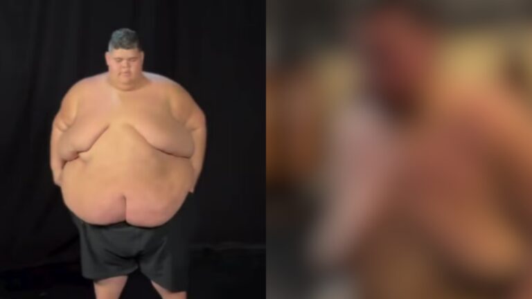 Gordão da XJ choca ao surgir sem camisa e mostrar o resultado após perder 130 kg