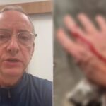 Saiba o que realmente aconteceu durante o ataque de pitbull ao âncora da Globo