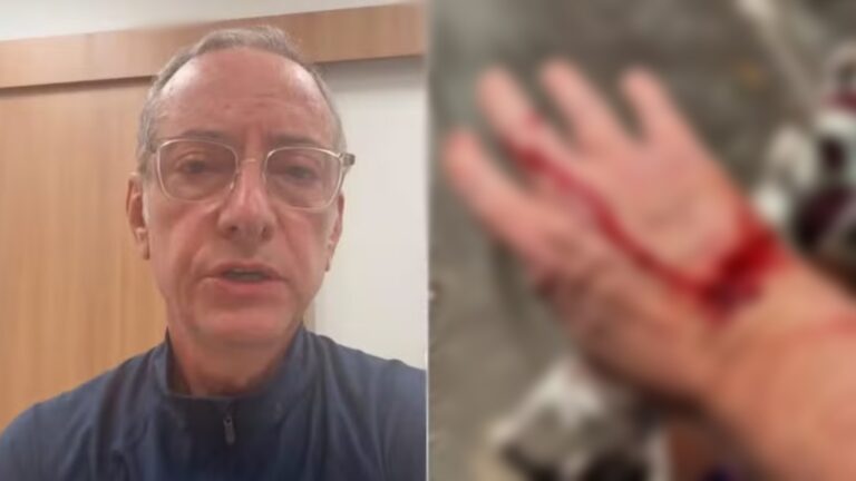 Saiba o que realmente aconteceu durante o ataque de pitbull ao âncora da Globo